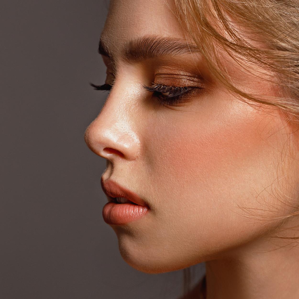 Non-surgical rhinoplasty results